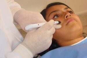 West Palm Beach Acupuncture Treatment