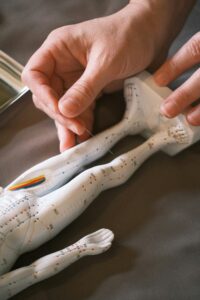 West Palm Beach Acupuncture Treatments 