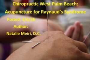 Chiropractic West Palm Beach: Acupuncture for Raynaud's Syndrome